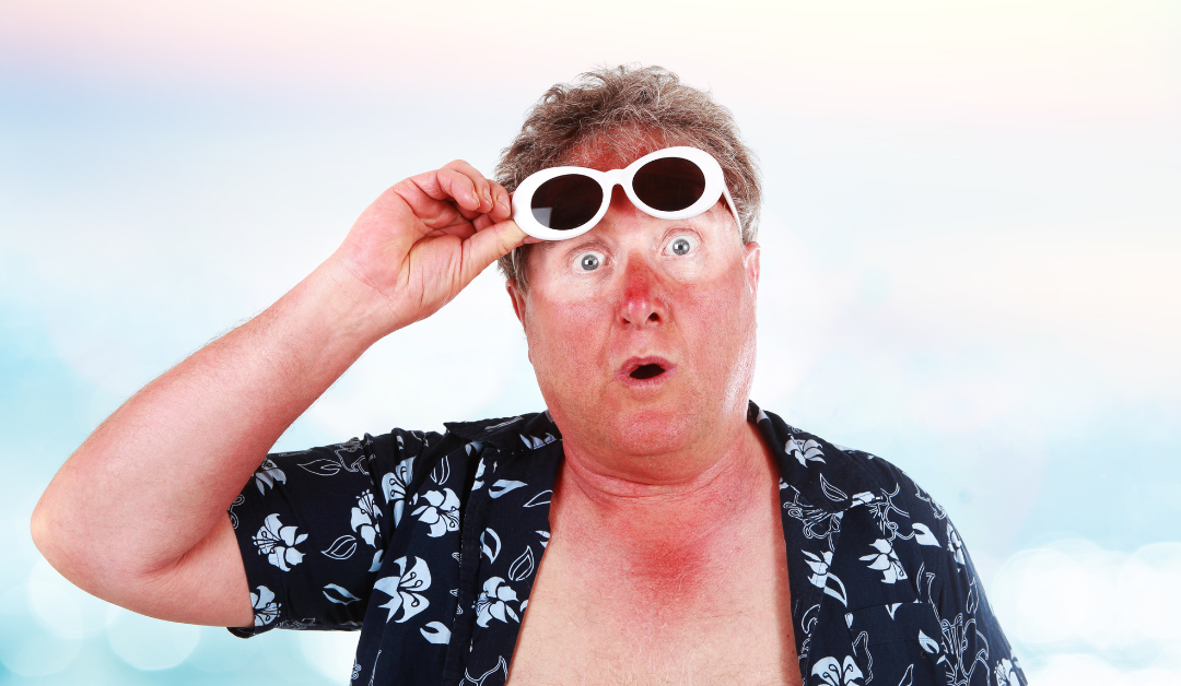 Stay Safe in the Sun: Easy Ways to Avoid Sunburn This Summer
