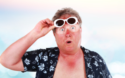 Stay Safe in the Sun: Easy Ways to Avoid Sunburn This Summer